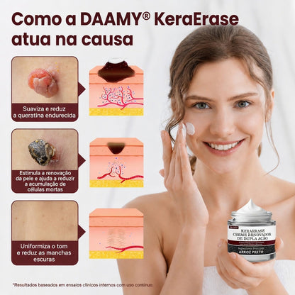 🔥𝑫𝑨𝑨𝑴𝒀® KeraErase Creme Renovador de Dupla Ação
