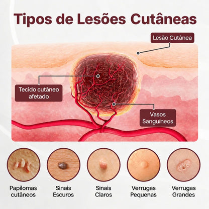 🔥𝑫𝑨𝑨𝑴𝒀® KeraErase Creme Renovador de Dupla Ação