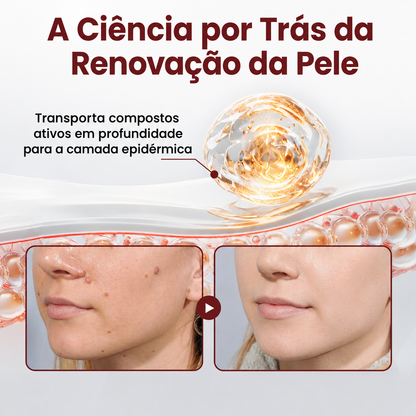 🔥𝑫𝑨𝑨𝑴𝒀® KeraErase Creme Renovador de Dupla Ação